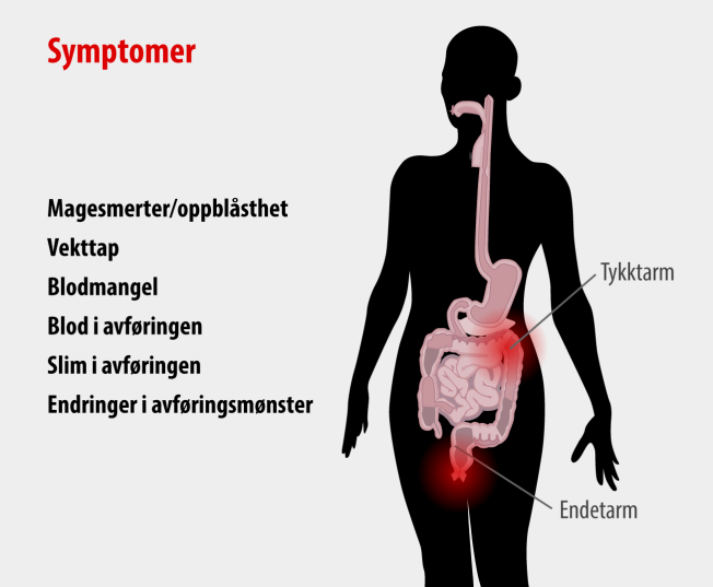 Kj Tt Som Kan Gi Tarmkreft Dette Er Symptomene Helse Og Medisin Vg